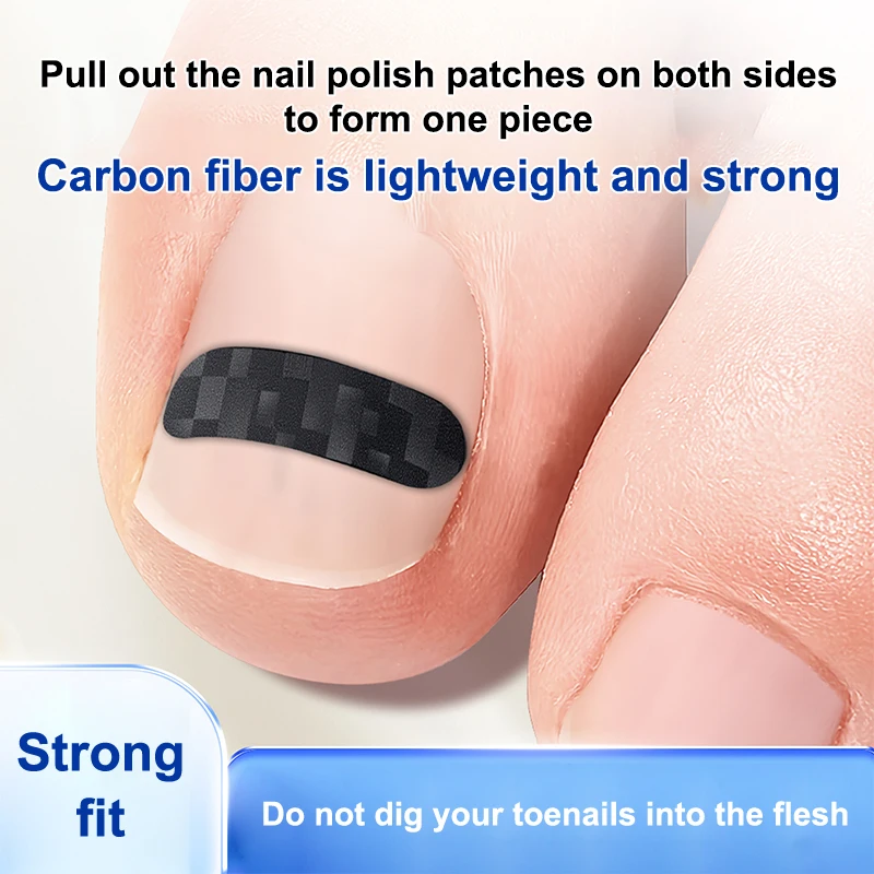 

1/5Pcs Carbon Fiber Ingrown Toe Nail Ingrown Toenail Correction Tool Elastic Patch Sticker Straightening Clip Brace