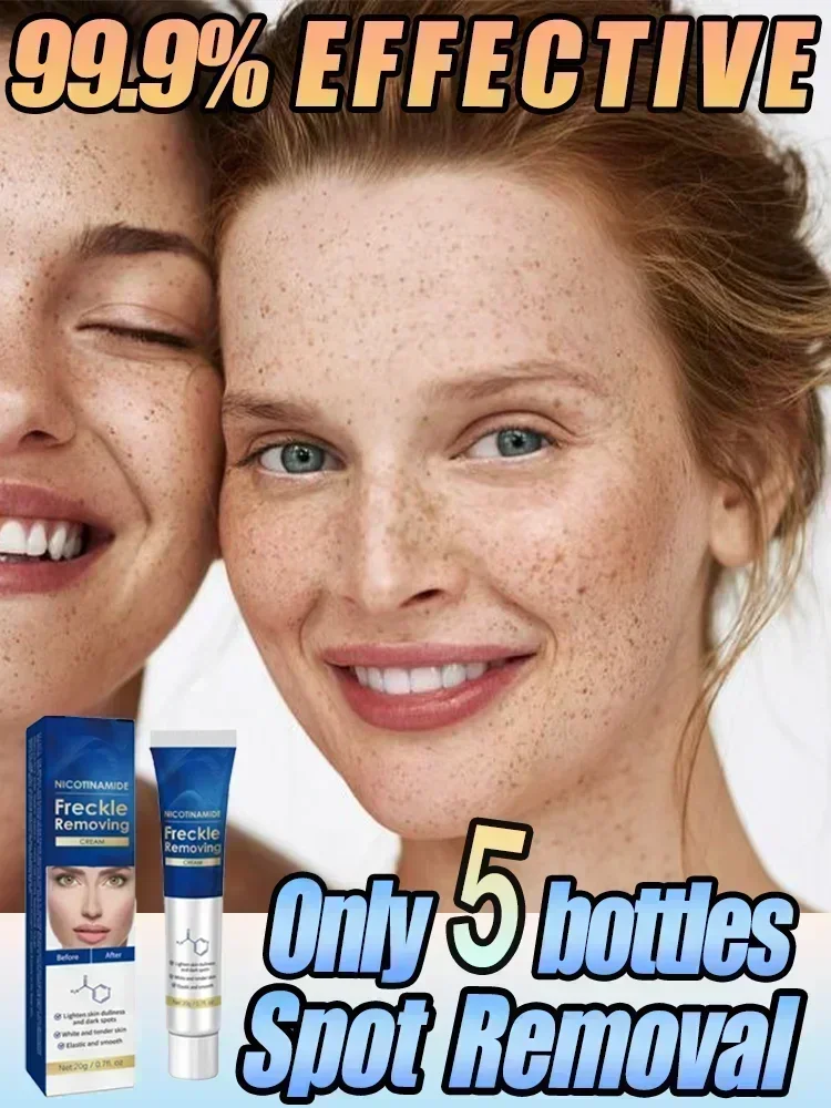 

Effictive Dark Spot Remover cream for Face Removing Freckle Melasma Chloasma Senile Plaques Sunburn Cyasma Chorioplaque Freckle