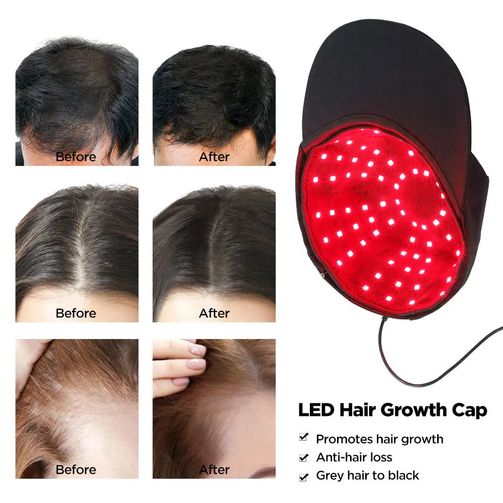 2026 New Infrared 96 LEDs Head Cover 660&850 nm Red Light Therapy Hair Growth Cap for Hair Regrowth Anti Hair Loss Relax Scalp