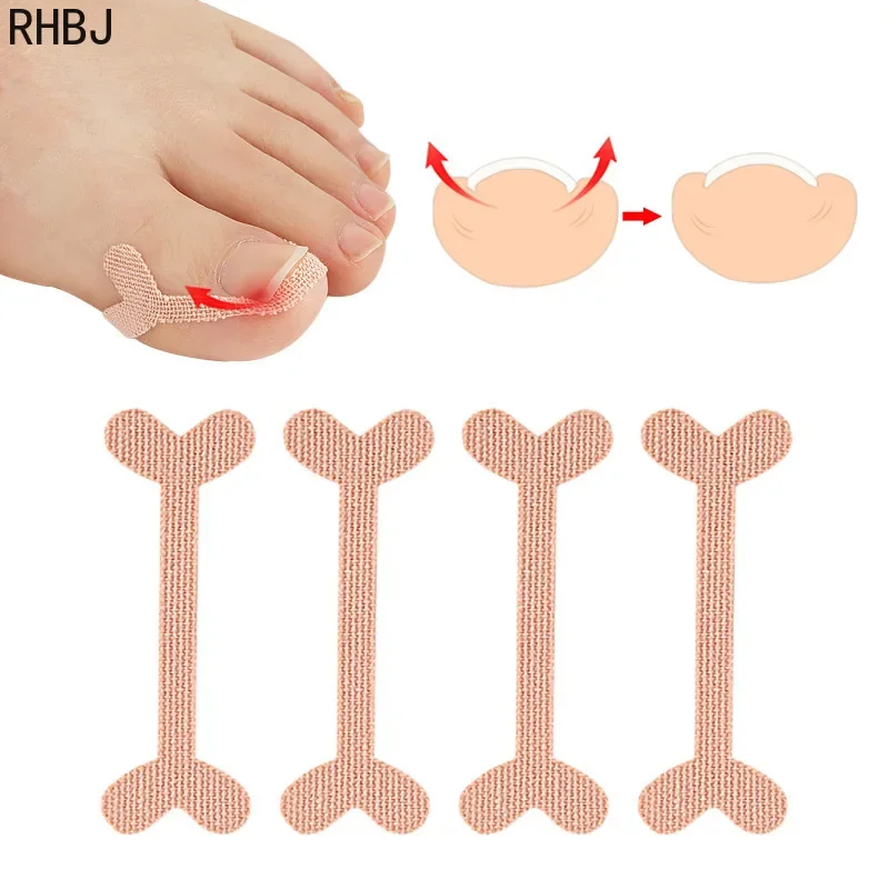 RHBJ dispositivo de ortodoncia con ranura para uñas de los pies, parche para uñas de pulgar, pedicura, Deformación de uñas de los pies, herramientas para el cuidado de los pies, nuevo