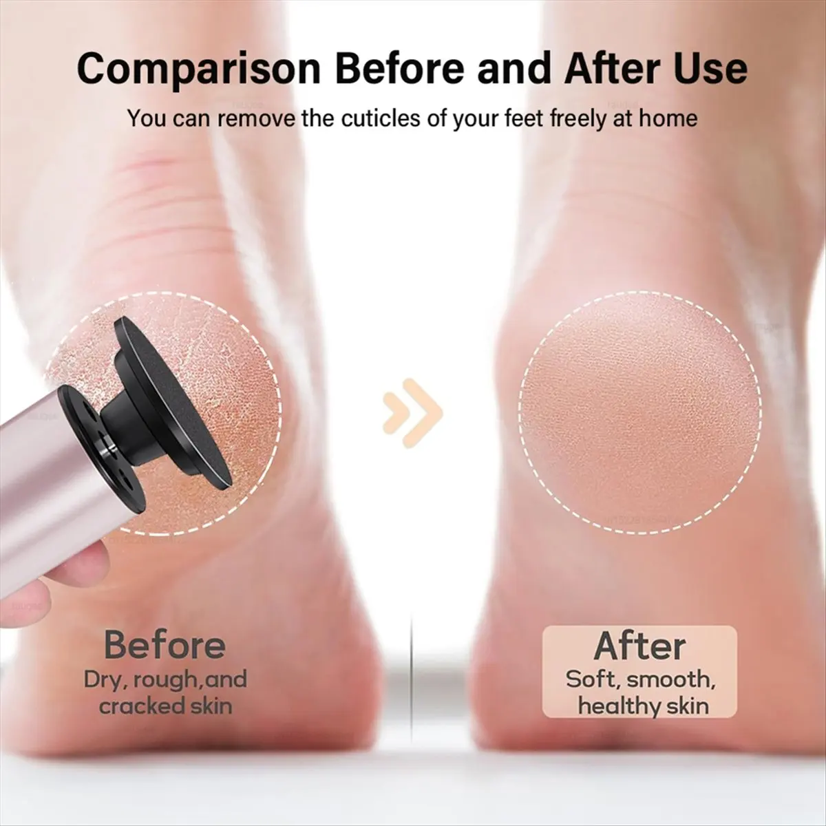 （ON SALE）Electric Foot Grinder Callus Remover for Feet Foot Exfoliation Sander Electric Foot File Pedicure Machine Black