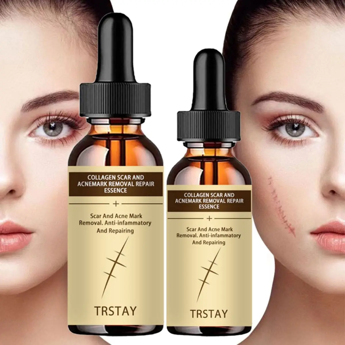 TRSTAY collagen bacteria scar and acne mark fade repair essence