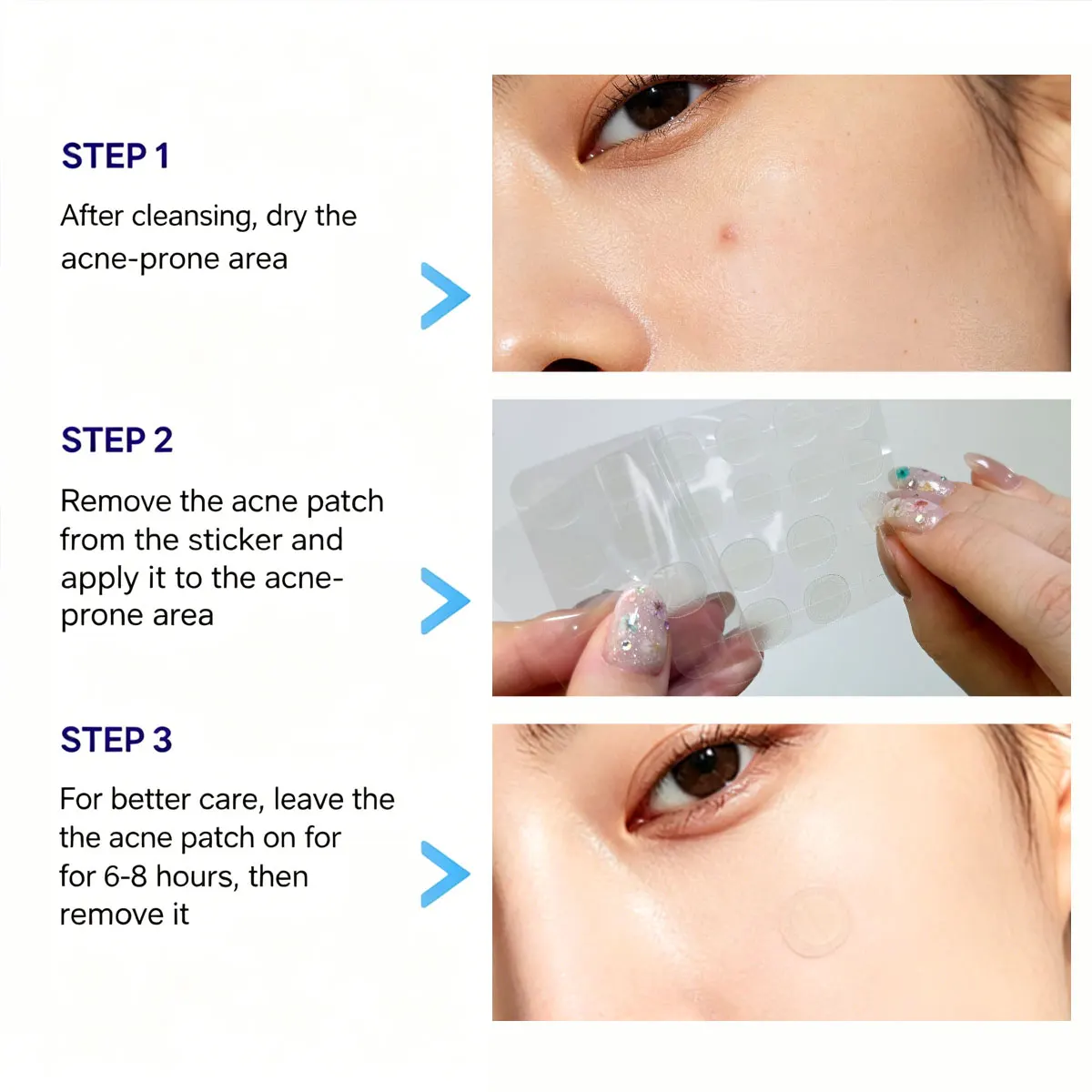 Mediheal Derma Clear Madecassoside Blemish Spot Patch,Lightweight & Breathable,Skin Flattening,Korean Skincare,Korean Makeup