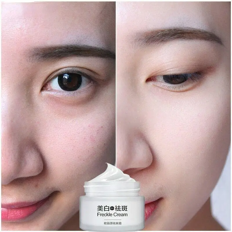 

Whitening Cream Freckle Cream Moisturizing Freckle Removing Nourishing Skin Care