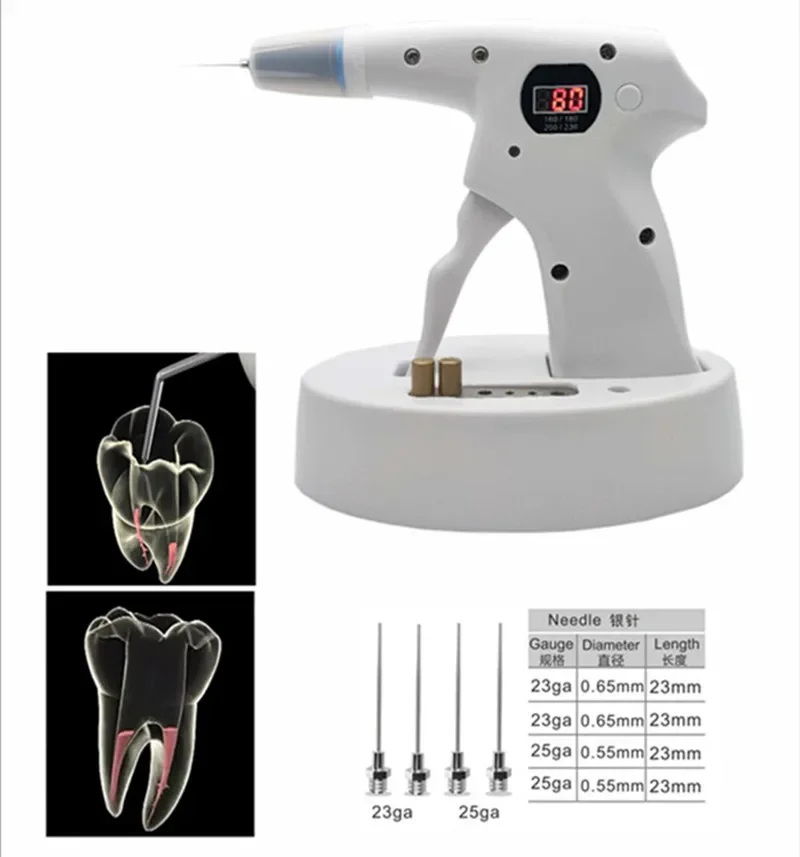 Endodontic Den tal Cordless Gutta Percha Obturation System 1 Obturation g u n+ 1 Obturation Pen