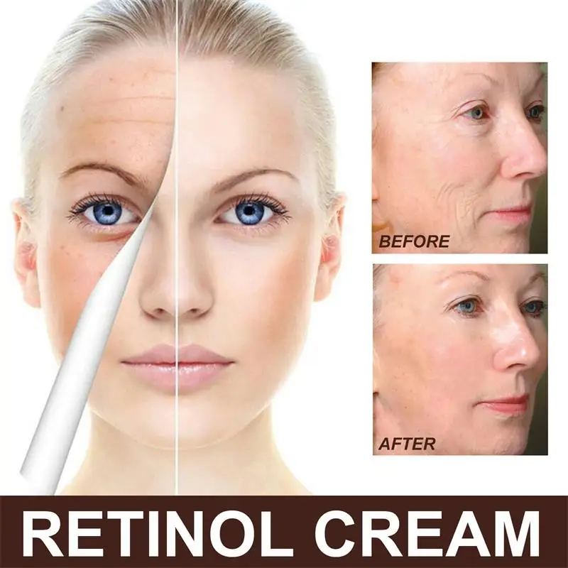 Neue Retinol Verjüngende Faltencreme 30g Gesicht Golden Befeuchten Natürliche Hautpflege Feuchtigkeitsspendende Feuchtigkeitscreme