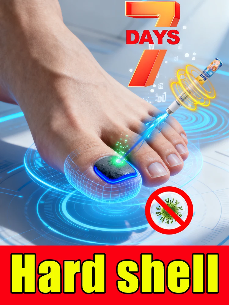 

Технология синего света второго поколения. Скажи прощай на гриб ногтей