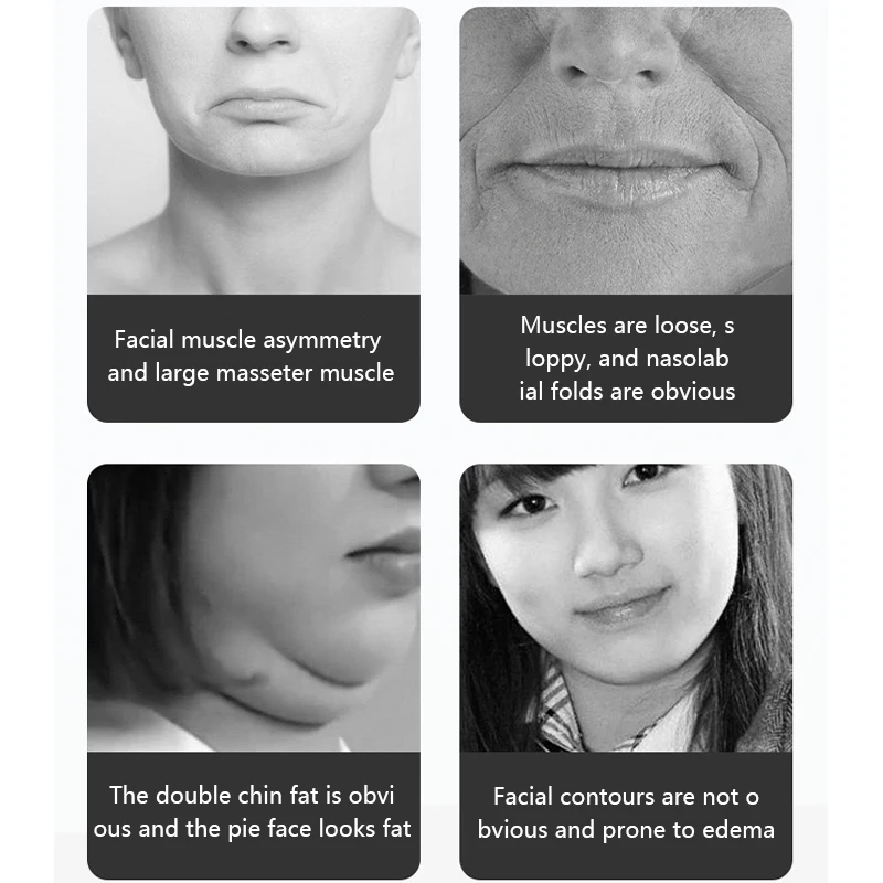 EMS 원격 이중 턱 제거 얼굴 리프팅 장치, 얼굴 탄력 LED 광자 치료, 뺨 리프트 업 벨트 미용 장치