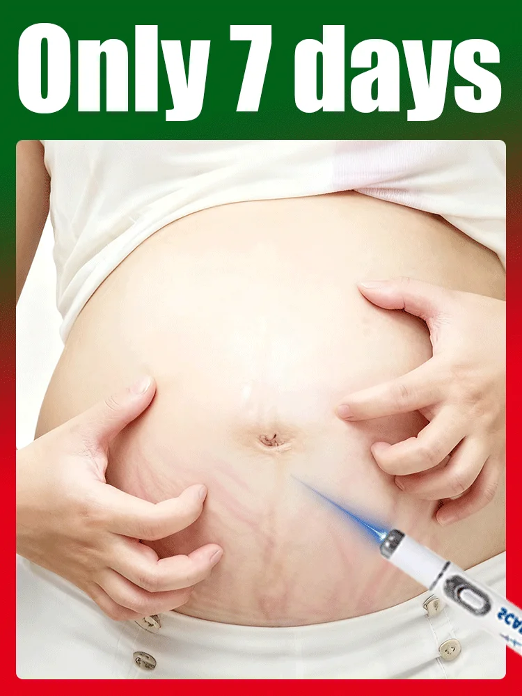 Verbesserte Dehnungsstreifen der 1. Generation repariert Narbenwurzel 