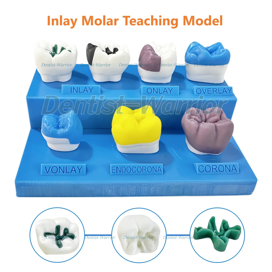 3D Printing Dental - 7 Tipos de Modelo Didático de