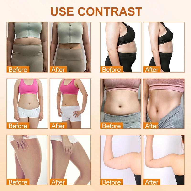 448KHZ INDIBA Physical Therapy CET RET Machine RF Face Lifting Weight Loss Fat Reduction Body Slimming Shaping Machine For Salon