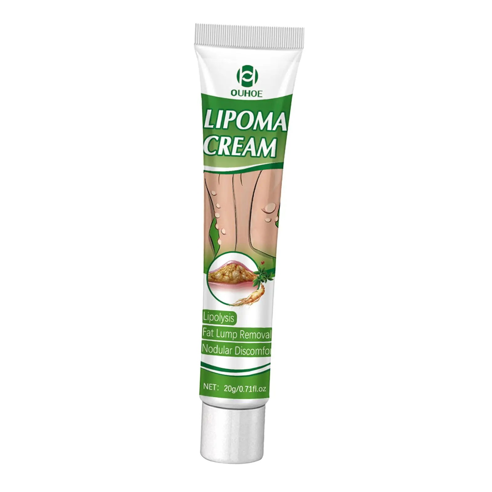 Crema per la rimozione del lipoma da 0,71 fl.oz Crema portatile per la cura della pelle Disagio nodulare Rimozione del lipoma