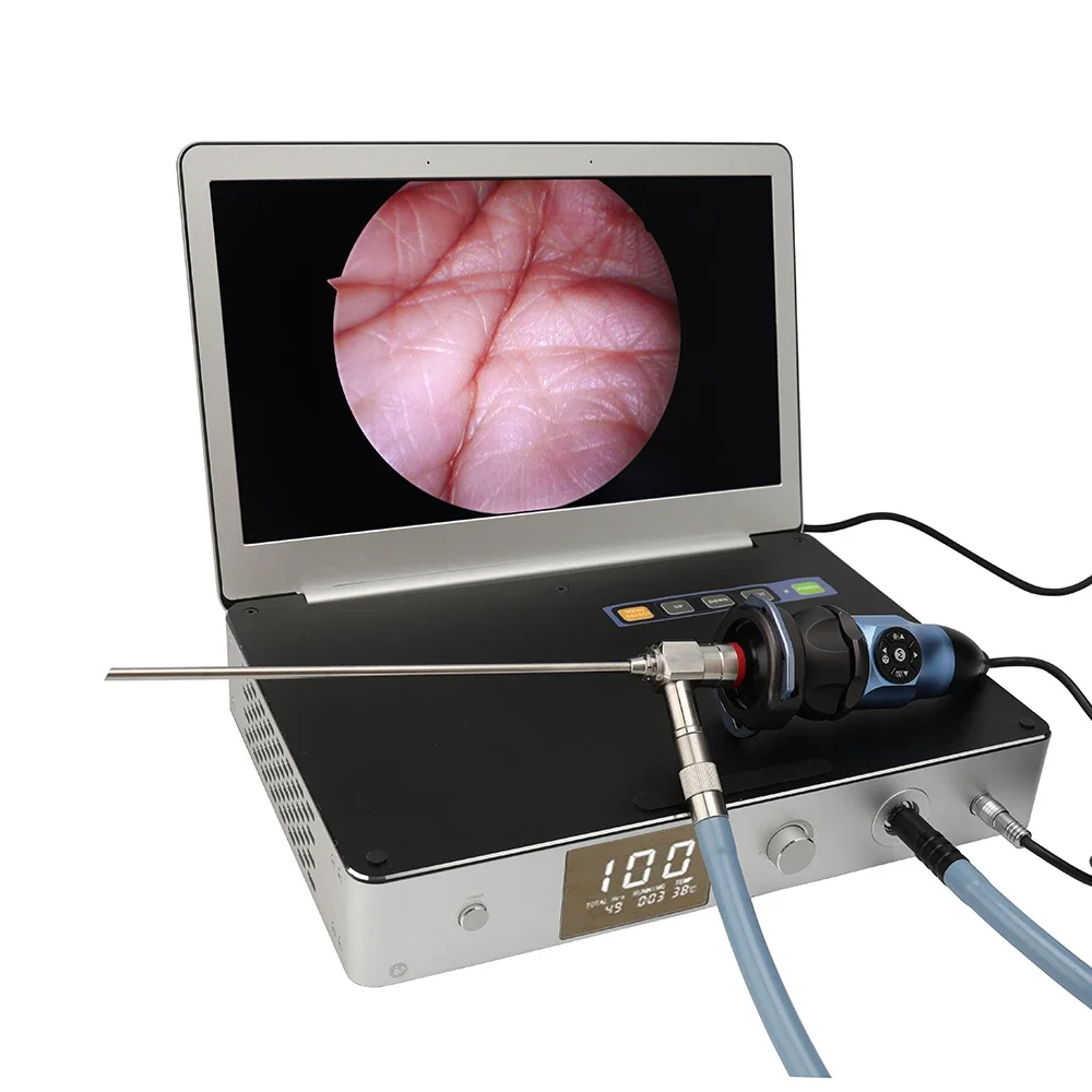 Cheap Medical Endoscopy Camera System USB 3.0 Ear Nose and Throat Endoscopy Camera Full hd Portable ENT Endoscopy Camera