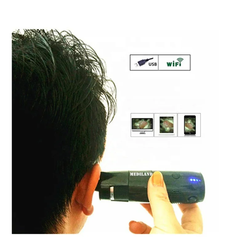 

Most Advanced Digital Wifi Otoscope ML-402