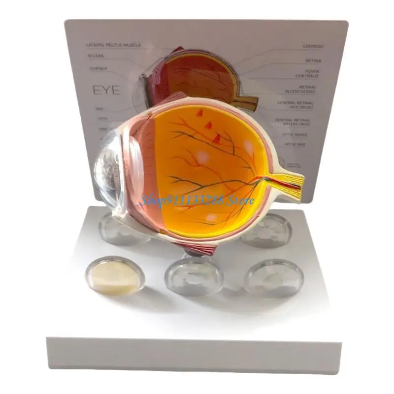 Human Anatomical Eye Model Realistic Pathological Eyeball Anatomy Model for Teaching Demonstration and Educational Use