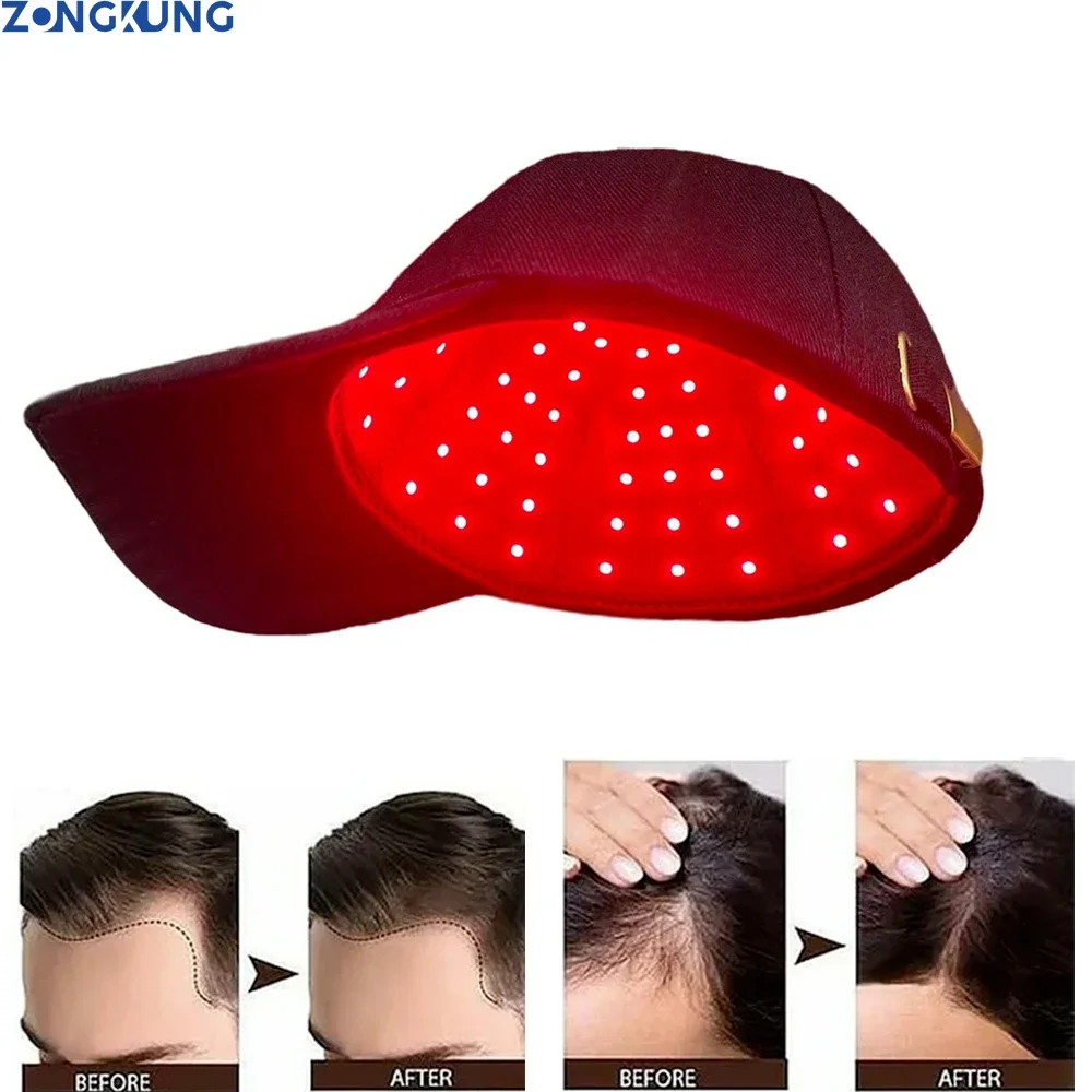 

96Pcs Leds 660nm&850nm Red Light Infrared Therapy Hair Growth Cap for Hair Regrowth Anti Hair Loss Relax Scalp Care Hat Anti