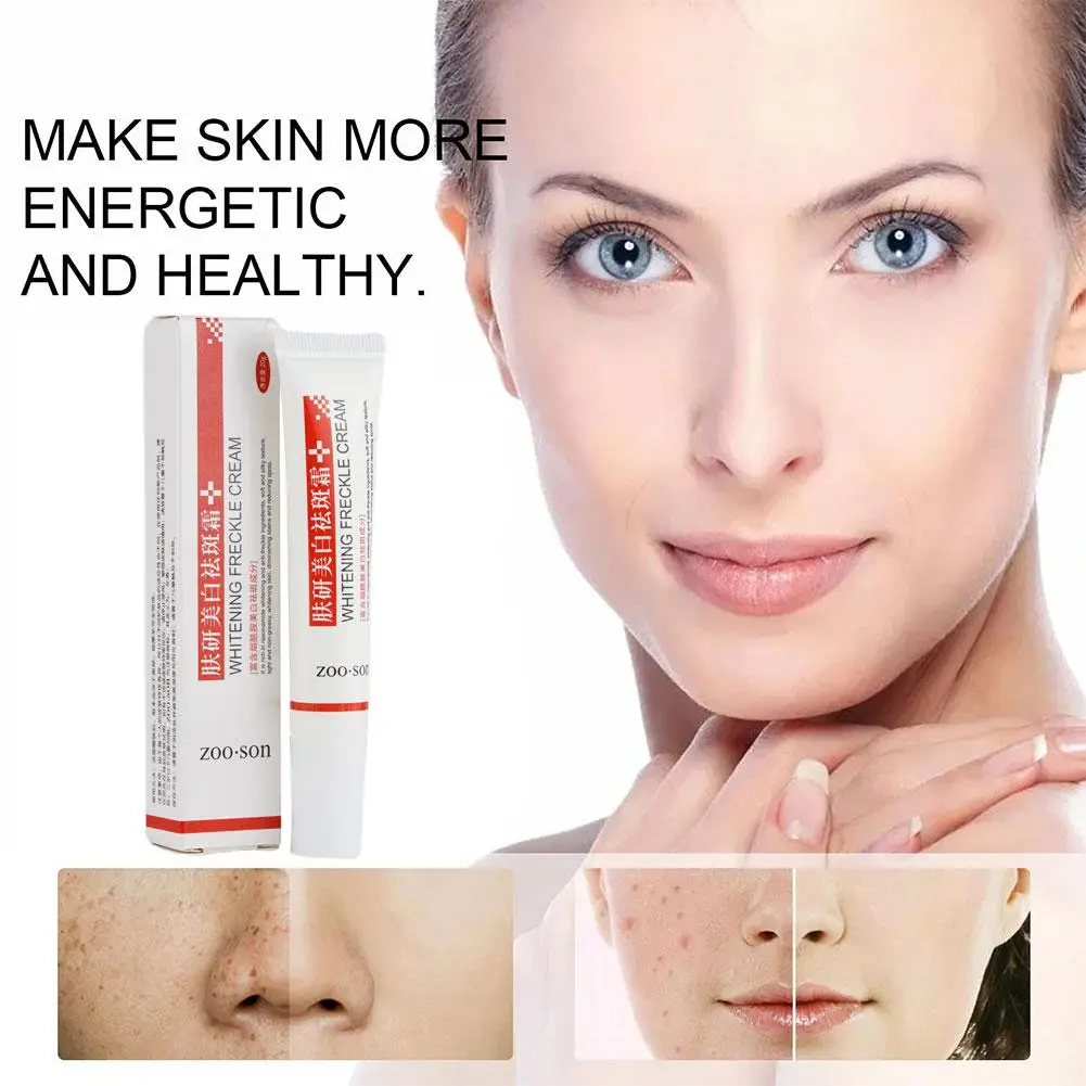 Whitening Freckle Cream Remove Dark Spots Anti Freckle Face Creams Niacinamide Fade Pigmentation Melasma Brighten Skin Care 20g