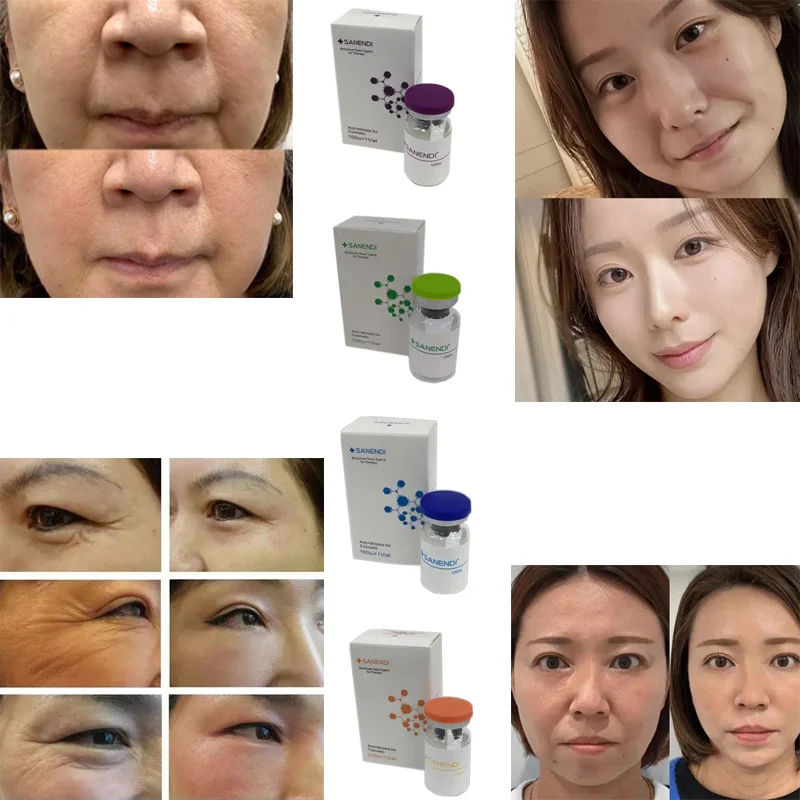 

Moisturizer maintenance face skin anti-wrinkle essence Treatment skin care