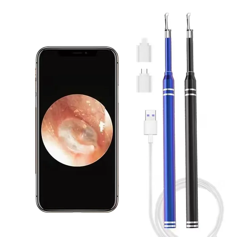 Smart Ear Cleaner Endoscope 5.5mm 3-in-1 Ear Otoscope Earwax Remover Picker with 2 Ear Scoops Support Android PC Type-C