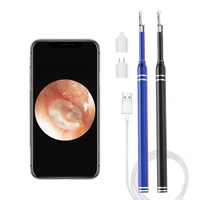 Smart Ear Cleaner Endoscope 5.5mm 3-in-1 Ear Otoscope Earwax Remover Picker with 2 Ear Scoops Support Android PC Type-C