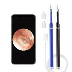 Smart Ear Cleaner Endoscope 5.5mm 3-in-1 Ear Otoscope Earwax Remover Picker with 2 Ear Scoops Support Android PC Type-C