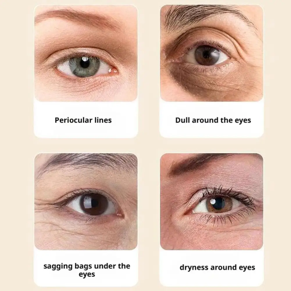 VC يضيء العين جوهر النفط كرة دوارة للعين يزيل الهالات السوداء مملة ممحاة العين حقيبة مغذية جوهر العين العناية بالعين كوريا #4