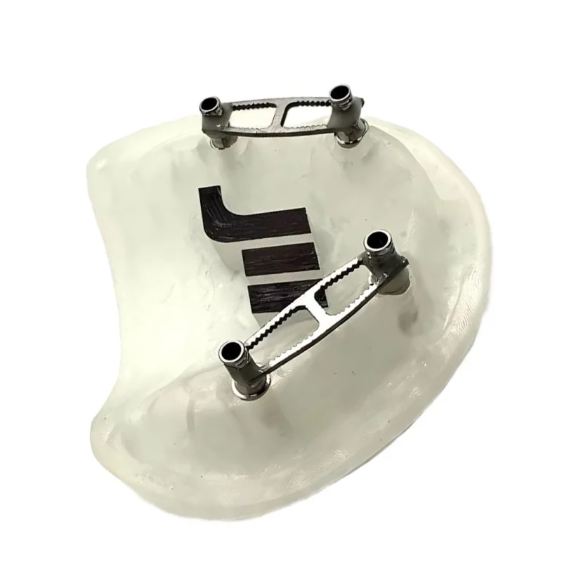 Dental Implant Impression Splinting Bar Dental Lab Fits Straumann & Nobel Temp Bridge & Multi-Implant Analog Connection 10Pcs