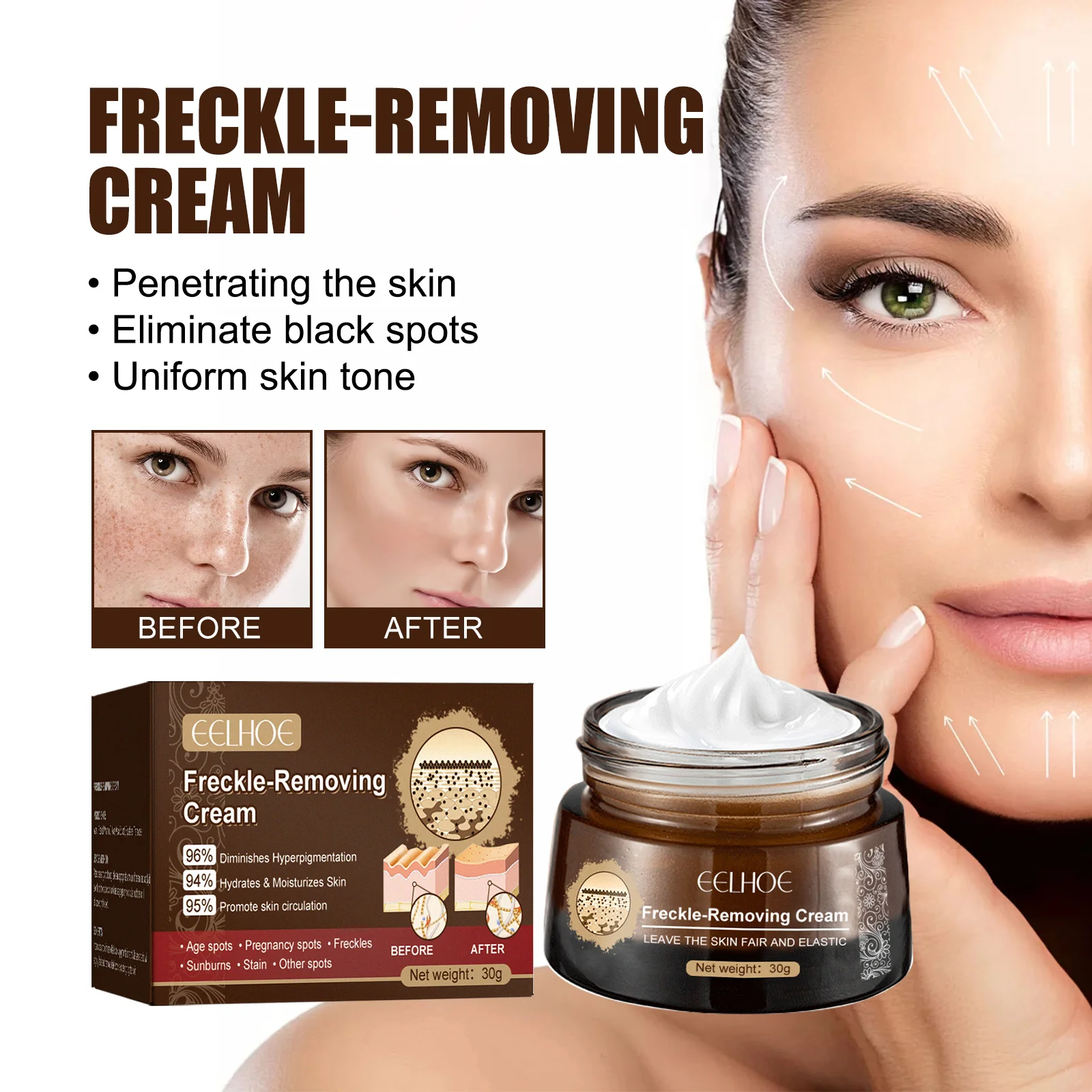 Nicotinamid Fade Freckles Improve Spot Cream Brightening Skin Eliminate Melanin Pigmentation Melasma Dark Spots Korean Skin Care