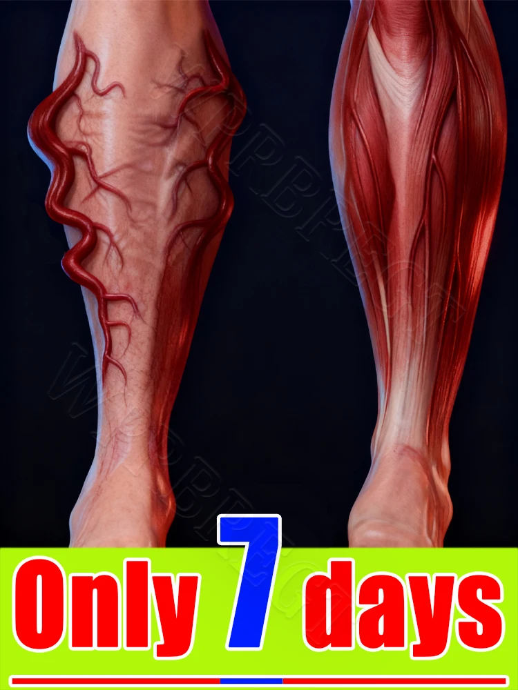 

Leg vein repair device, leg vein machine, repair