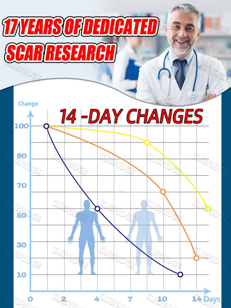 Bolígrafo de luz azul para resolver cicatrices, envío gratis, herramientas para el cuidado de los cicatrices, indoloro, uso doméstico, fácil de usar