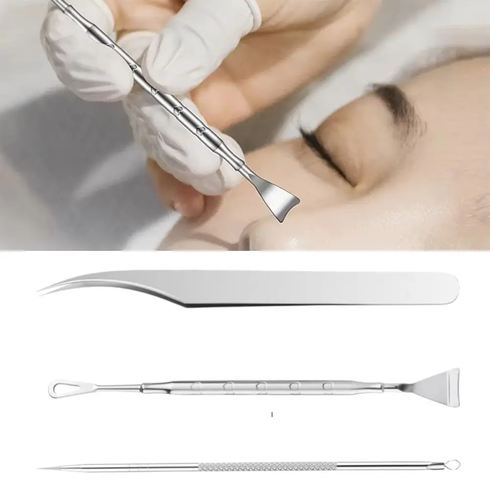 Double Head Blackhead Remover Comedone Removal Whitehead Popping Zit Blemish Extractor Tool Stainless Steel Pimple Popper Tool