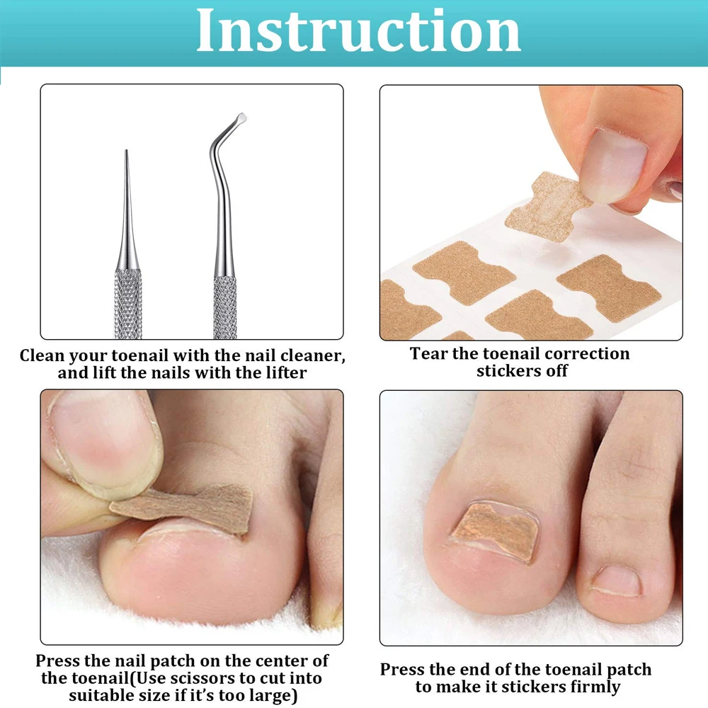 Ingrown Toenail Tools Set Ingrown Toenail Correction Patch Stickers Corrector Pedicure Tool Ingrown Toe Nail Treatment Foot Care