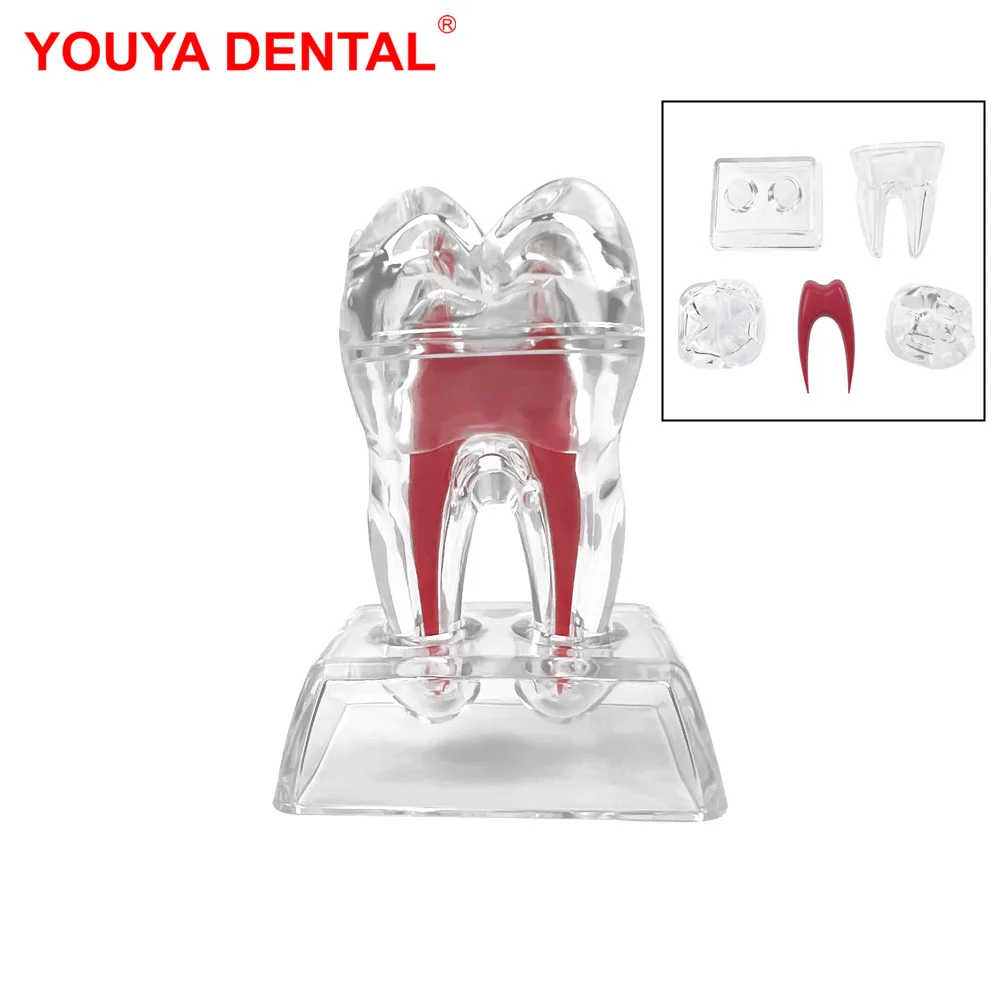 Teeth Model Dental Anatomical Structure Detachable Dental Anatomical Model Transparent Tooth Disintegration Model Dental Anatomy