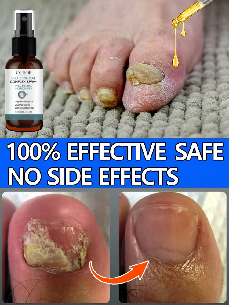 

Nails become beautiful Eliminates various nail problems and repairs nails.