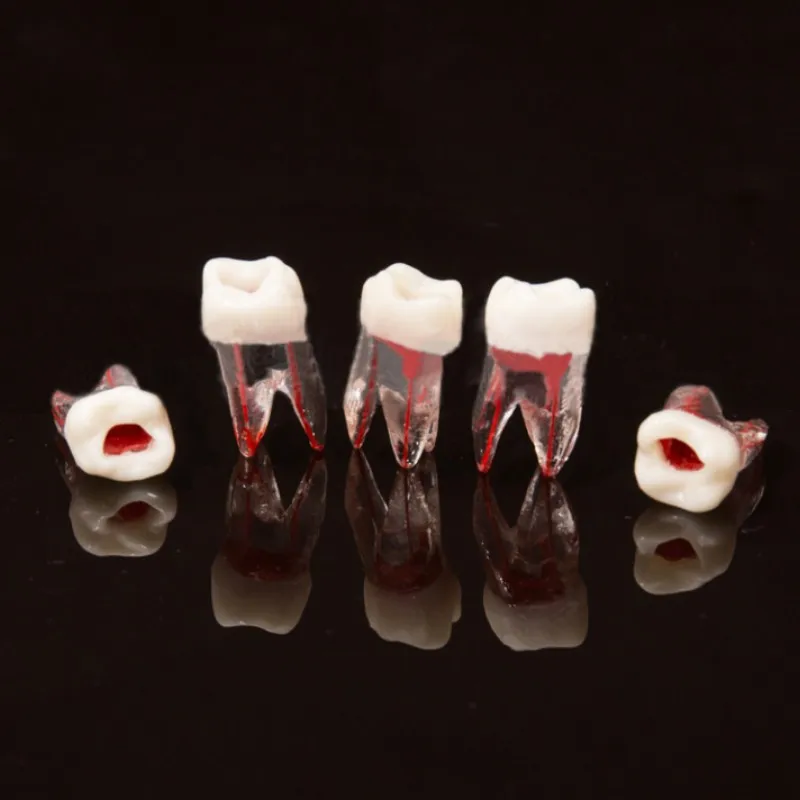 1pcs Dental Tooth Root Canal Model For RCT Practice Pulp Cavity Clear Resin Teaching Teeth Model 1:1 Dentistry Lab Tools