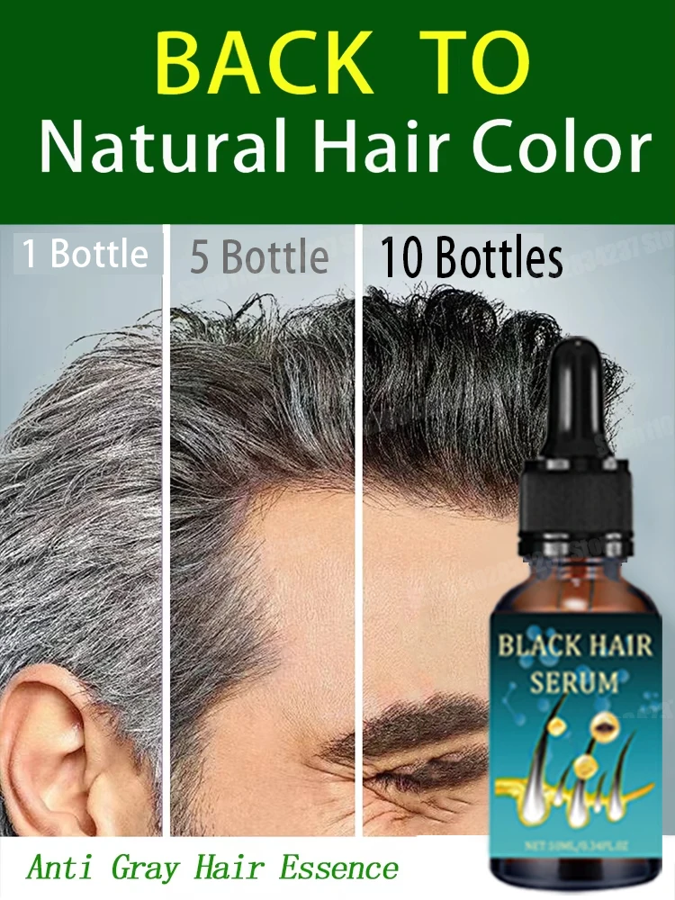 Revitalize Your Hair Color and Health with Anti-Grey Hair Natural Anti-Grey Serum Remedy Healthy Essence Serum New