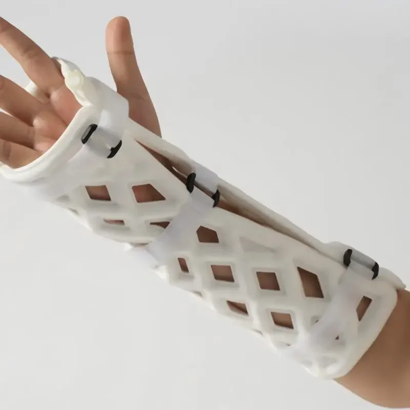 Fully Breathable and Waterproof External Fixation Braces for Hand Orthotics Portable Use fast shipping