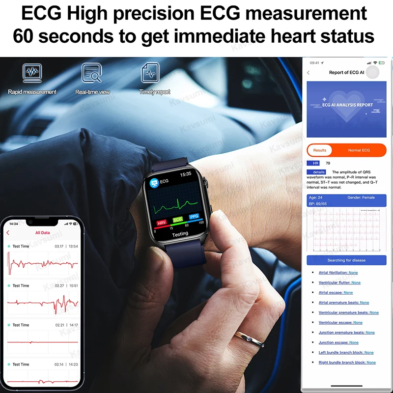 Reloj inteligente deportivo no invasivo para hombres, pulsera con control de la salud, el ácido úrico y los lípidos en sangre, ECG + PPG, llamadas