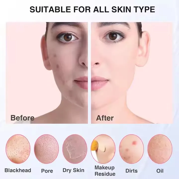 فرشاة تنظيف الوجه المقاومة للماء من سونيك للرجال والنساء، فرشاة تنظيف الوجه الكهربائية القابلة لإعادة الشحن