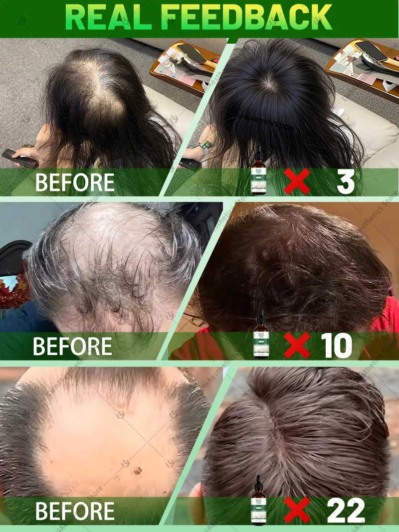 ᵀʰⁱⁿⁿⁱⁿᵍ ʰᵃⁱʳ ⁱˢ ⁿᵒ ˡᵒⁿᵍᵉʳ ᵃ ᵖʳᵒᵇˡᵉᵐ‧ ᶜʰᵒᵒˢᵉ ᵒᵘʳ ʰᵃⁱʳ ᵍʳᵒʷᵗʰ ᵖʳᵒᵈᵘᶜᵗˢ ᵗᵒ ᵐᵃᵏᵉ ʸᵒᵘʳ ʰᵃⁱʳ ᵗʰⁱᶜᵏᵉʳ ᵃⁿᵈ ˢᵗʳᵒⁿᵍᵉʳ‧