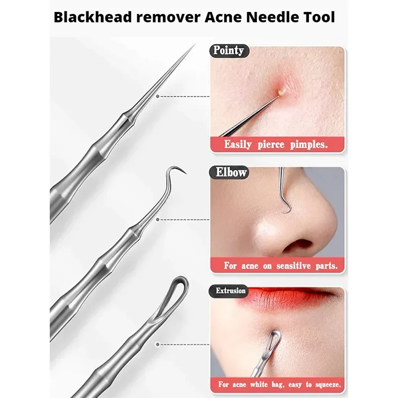 Pimples Blackhead Clip Tweezers Acne Blackhead Removal Needles Beauty Artifact Blemish Extractor Remover Needle Tool Wholesale