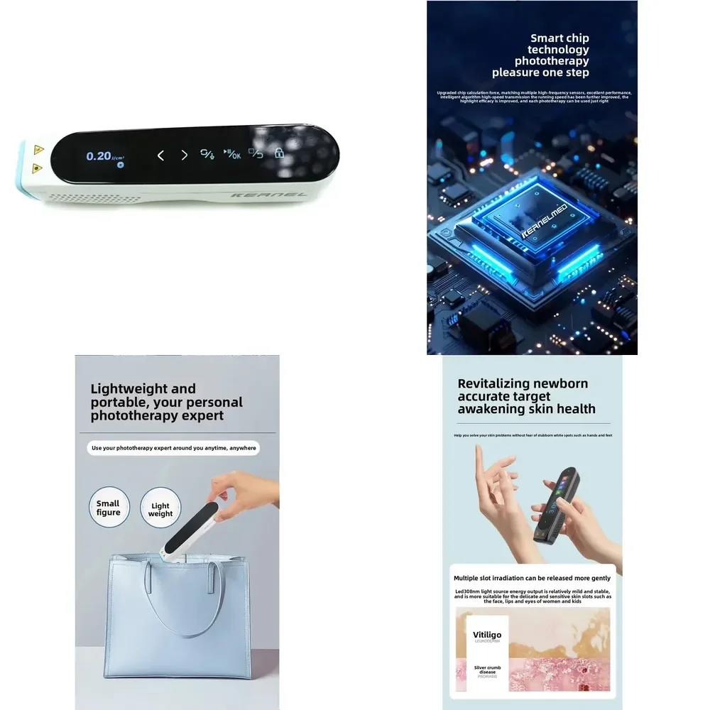 Latest CN-308P Durable LED 308nm UVB Excimer Targeted 308nm Equipment