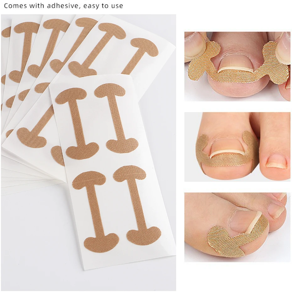 คุด Toenail Correction สติกเกอร์กาว Toenail Patch ยืดหยุ่นเล็บ Corrector สติกเกอร์ Foot Care เครื่องมือ