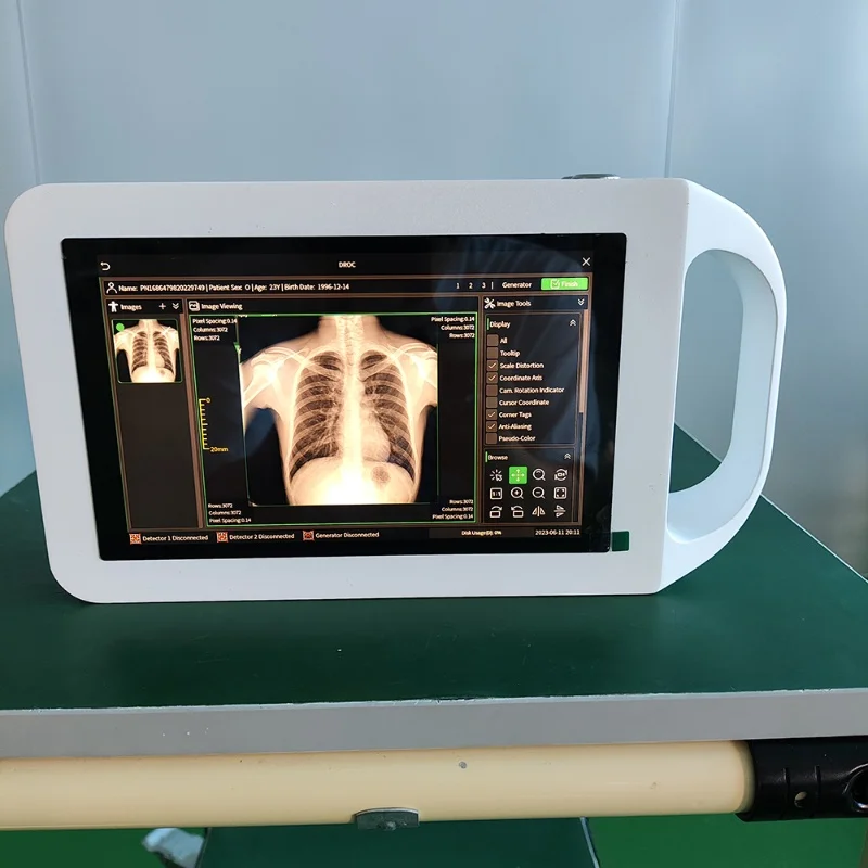 Handheld X-Ray Scanner for Humans and Animals: Real-World Use Cases and ...