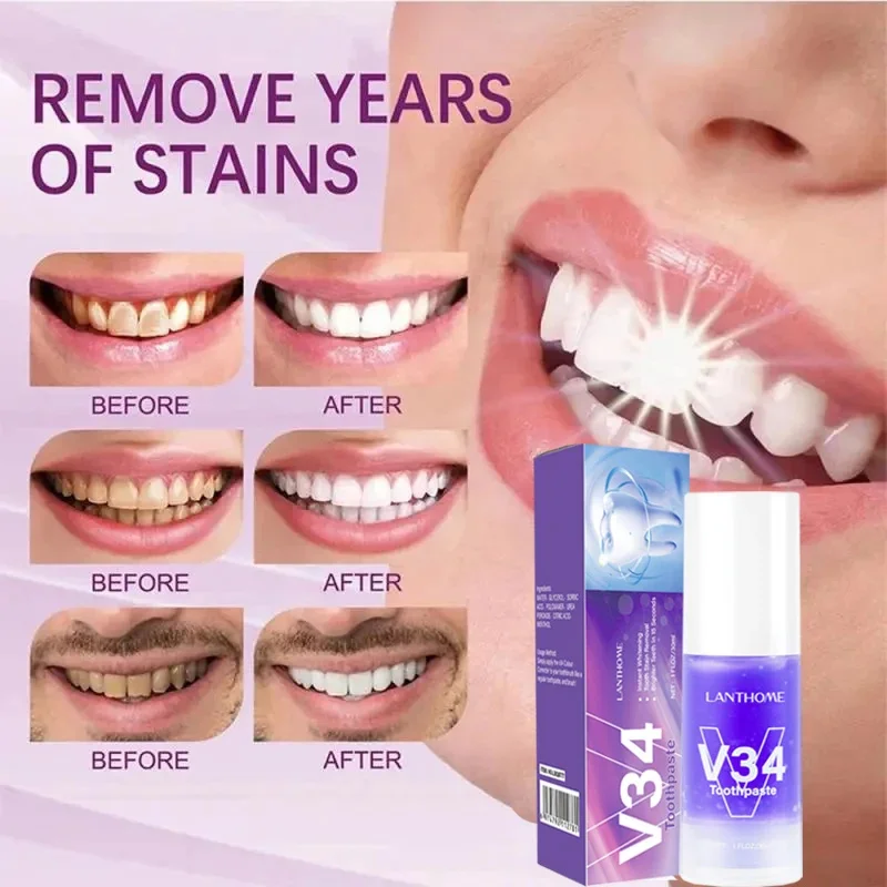 V34 Teeth Whitening Toothpaste Pen Remove Plaque Stains Cleaning Oral Hygiene Bleaching Dental Tools Fresh Breath Beauty Health