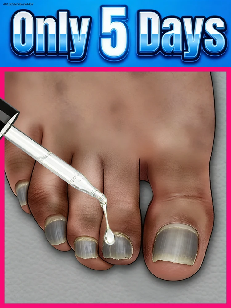 Sᴀʏ ɢᴏᴏᴅʙʏᴇ ᴛᴏ ᴅᴀᴍᴀɢᴇᴅ ɴᴀɪʟs, ʀᴇɴᴇᴡ ᴛᴇxᴛᴜʀᴇ ғᴏʀ sᴍᴏᴏᴛʜ ᴘᴇʀғᴇᴄᴛɪᴏɴ.