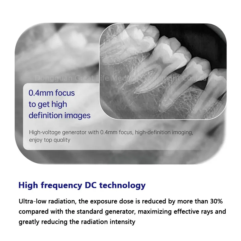 Greatlife mesin sinar X gigi, alat peralatan kedokteran gigi jarak 105mm kamera sinar X portabel sistem Sensor gambar RVG