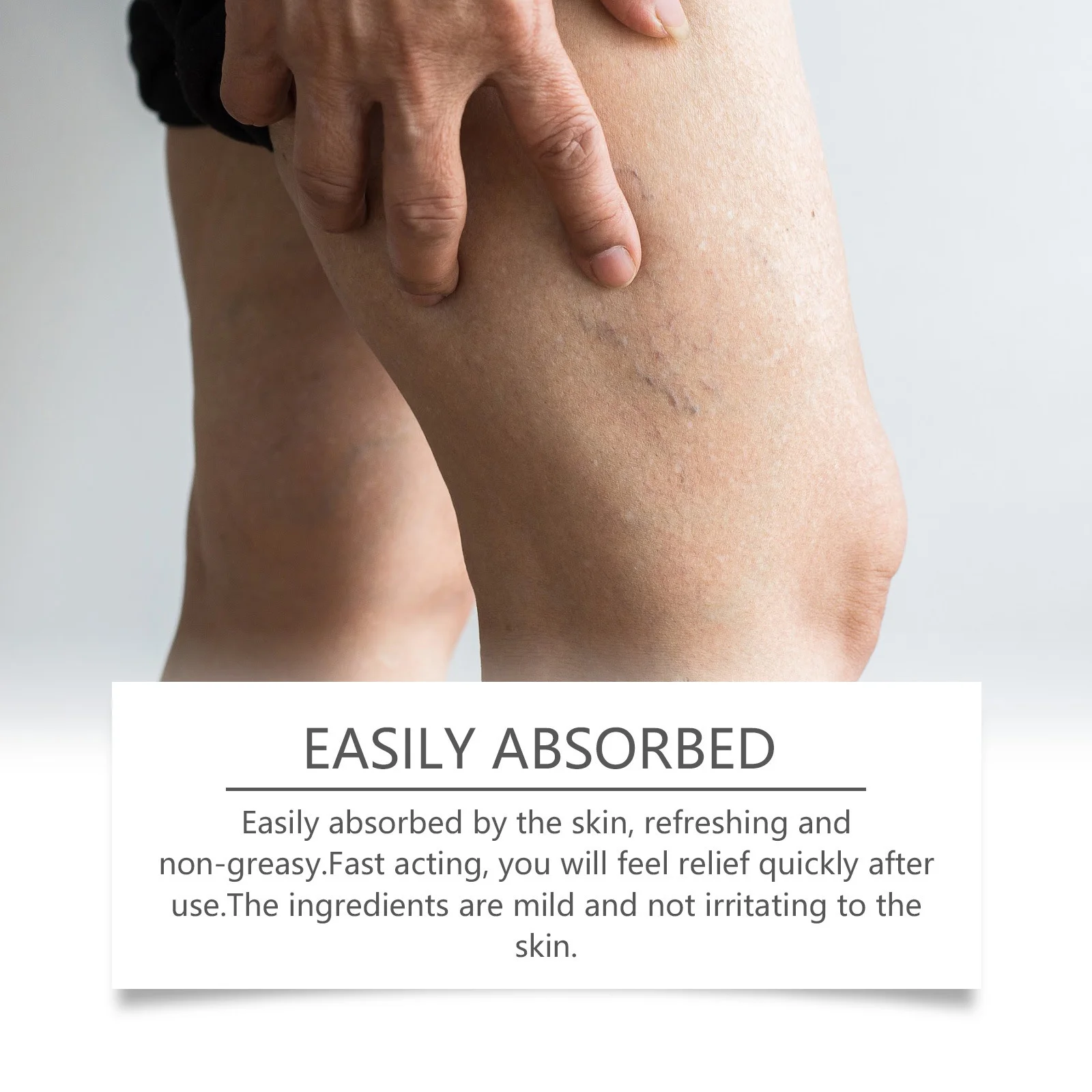 كريم تخفيف الدوالي تشنجات التهاب الأوعية الدموية التهاب الوريد الساقين شكل الانتفاخات الألم إزالة التهاب الأنجي وجع الأوردة العنكبوتية مرهم