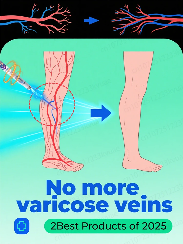 

Say goodbye to spider legs in 24 hours and make blood flow back more easily