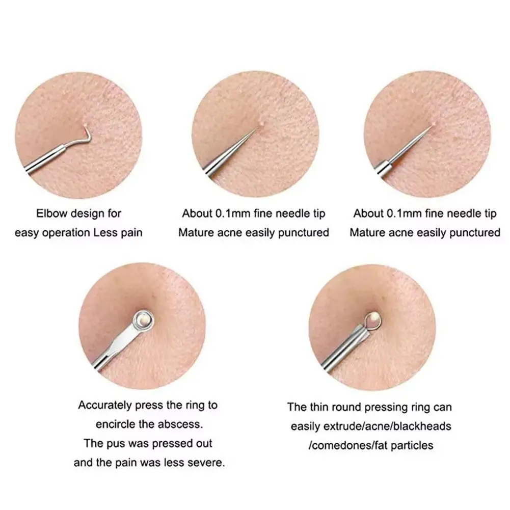 Silver Blackhead Comedone Black Spot Pimple Blemish Remover Skin Care Women Beauty Acne Treatment Pore Cleanser Needle Hook